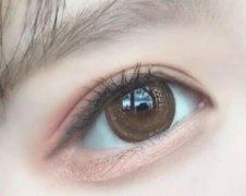 开外眼角的后遗症是什么?开外眼角有哪些危害?